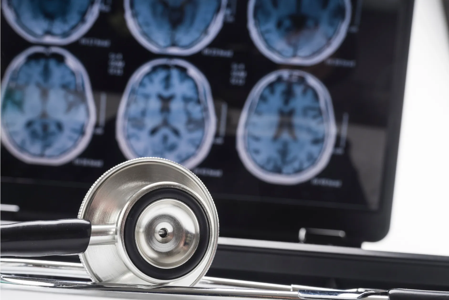 Symptoms of Alzheimers and Parkinson's disease can be reduced from RLT as it promotes neurin survival, reduces inflammation and improves mental performance.